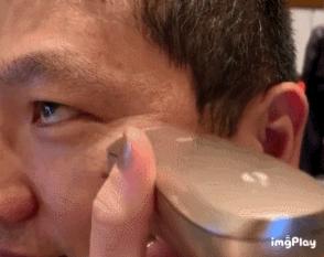 去斑点最有效方法医美去除斑痕,脸上暗沉有斑点可以做什么医美