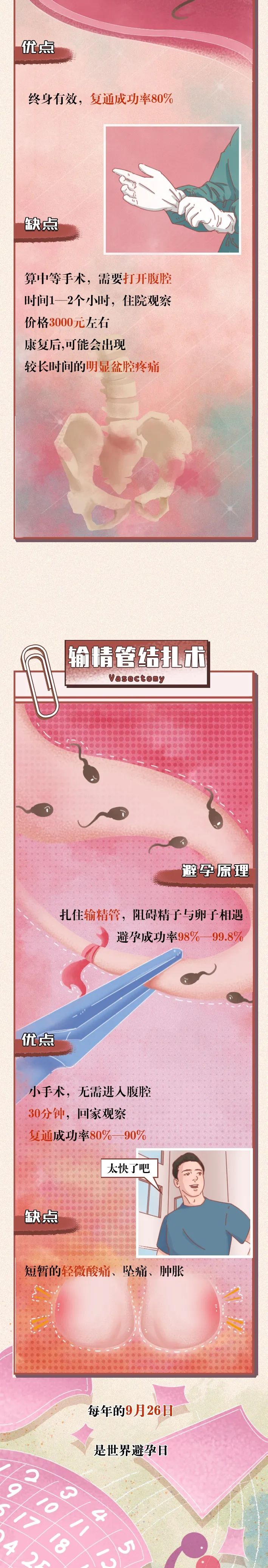 正确避孕的全过程，“第一次”之前必看