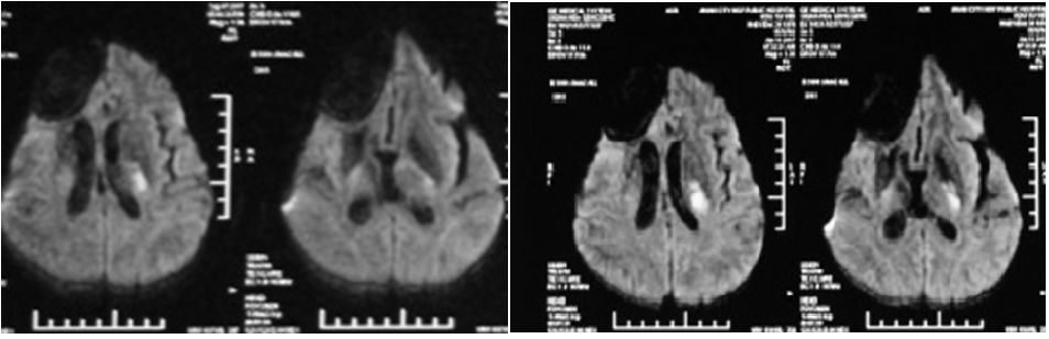 从基础到应用——MMSE、MoCA量表的使用，知多少？