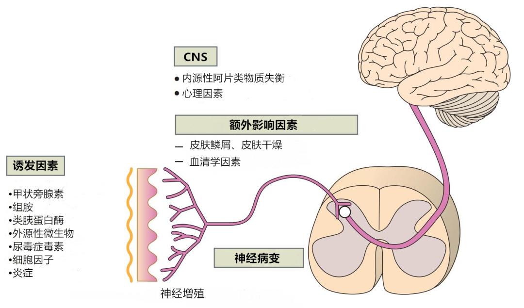 肾病瘙痒,肾病引发的瘙痒怎么治