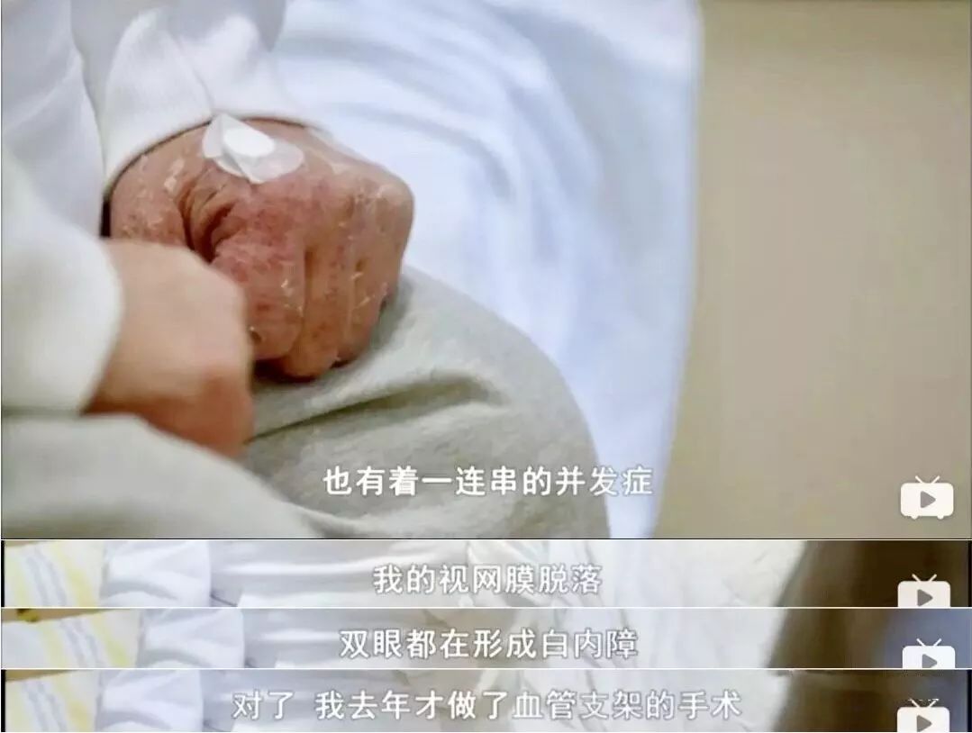 冬天干肌肤补水面膜,女生冬天脸干燥起皮用什么面膜