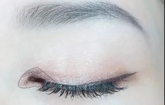 眼综合包含在眼综合吗,眼综合每个人都适合吗