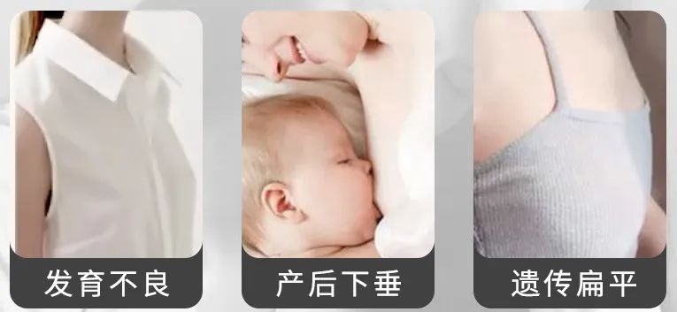 有什么方法可以丰胸不用丰胸产品,其实丰胸很简单呀