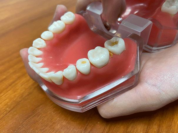 儿童嚼口香糖的好处和坏处,嚼口香糖有优缺点吗