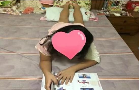 骨折移位手法复位,骨折移位做手术还是石膏固定