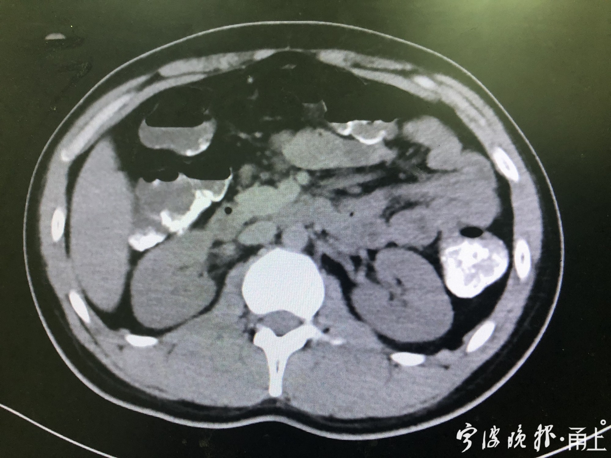 宁波21岁男子沉迷剧本杀,22岁玩剧本杀吓成脑出血