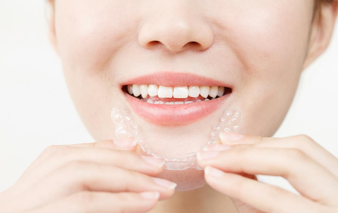 时代天使真的有品牌价值吗,时代天使隐形矫正效果好吗