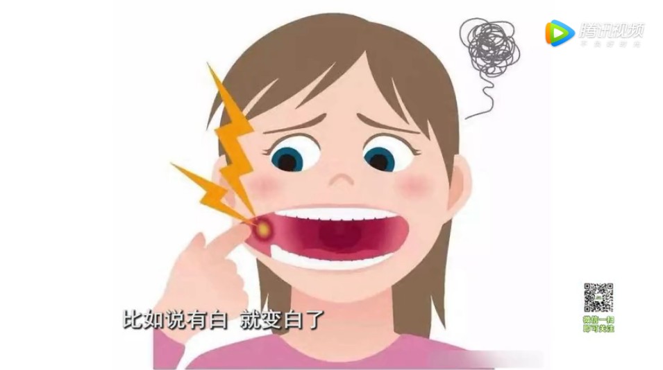 上颚口腔溃疡癌的症状,植物神经紊乱口腔溃疡多久会变癌