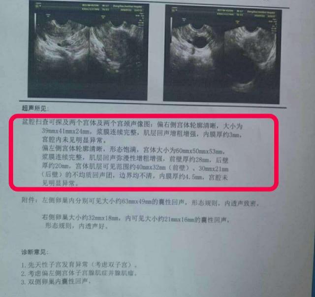腺肌症子宫切了会影响夫妻感情吗,子宫腺肌症会宫腔分离吗