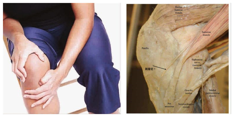 一条腿膝盖疼是关节炎吗,膝盖有一种奇怪的感觉但不是痛