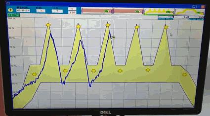 阴道里脱出块“肉”！