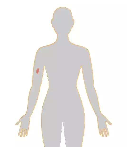 四个早期症状告诉你得了癌症,四种情况你有癌细胞