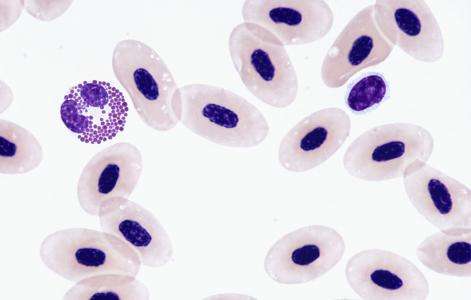 慢粒白血病知识讲座,慢粒白血病基因检测多少为安全