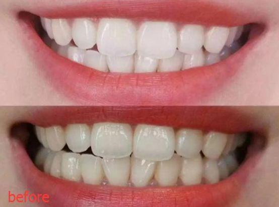 杨颖和姚晨演技,姚晨和杨颖谁的嘴巴大