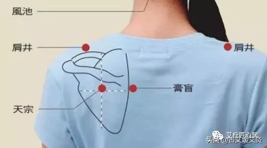 肩胛骨有结节一定有乳腺增生吗,肩胛缝有结节乳腺就有结节吗