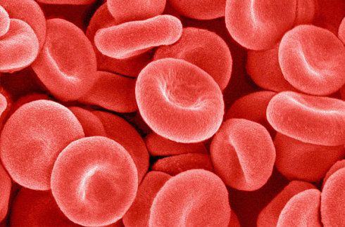 新生儿溶血性黄疸多久可以好,新生儿溶血和血型有关系吗