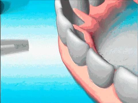 男子梅毒症状,男子被查梅毒后续