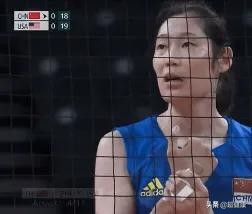 朱婷手腕有伤为什么不做手术,朱婷回应手腕伤情正系做手术