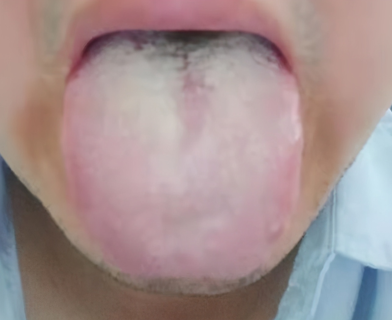 气虚导致的大汗淋漓怎么调,一动就大汗淋漓是体虚吗