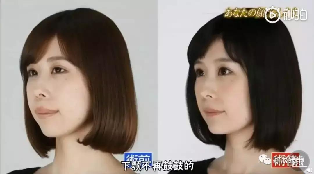 那些整容脸真的觉得自己好看吗,为什么整容以后都是一样的网红脸