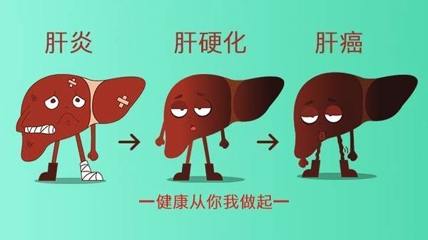 肝脏结节是恶性的吗,肝脏结节恶性的几率大吗