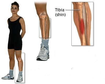 骨膜炎的症状是什么吃什么药,小腿骨膜炎的症状是什么