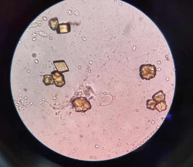 看尿酸化验单,检查尿酸600以上的图片
