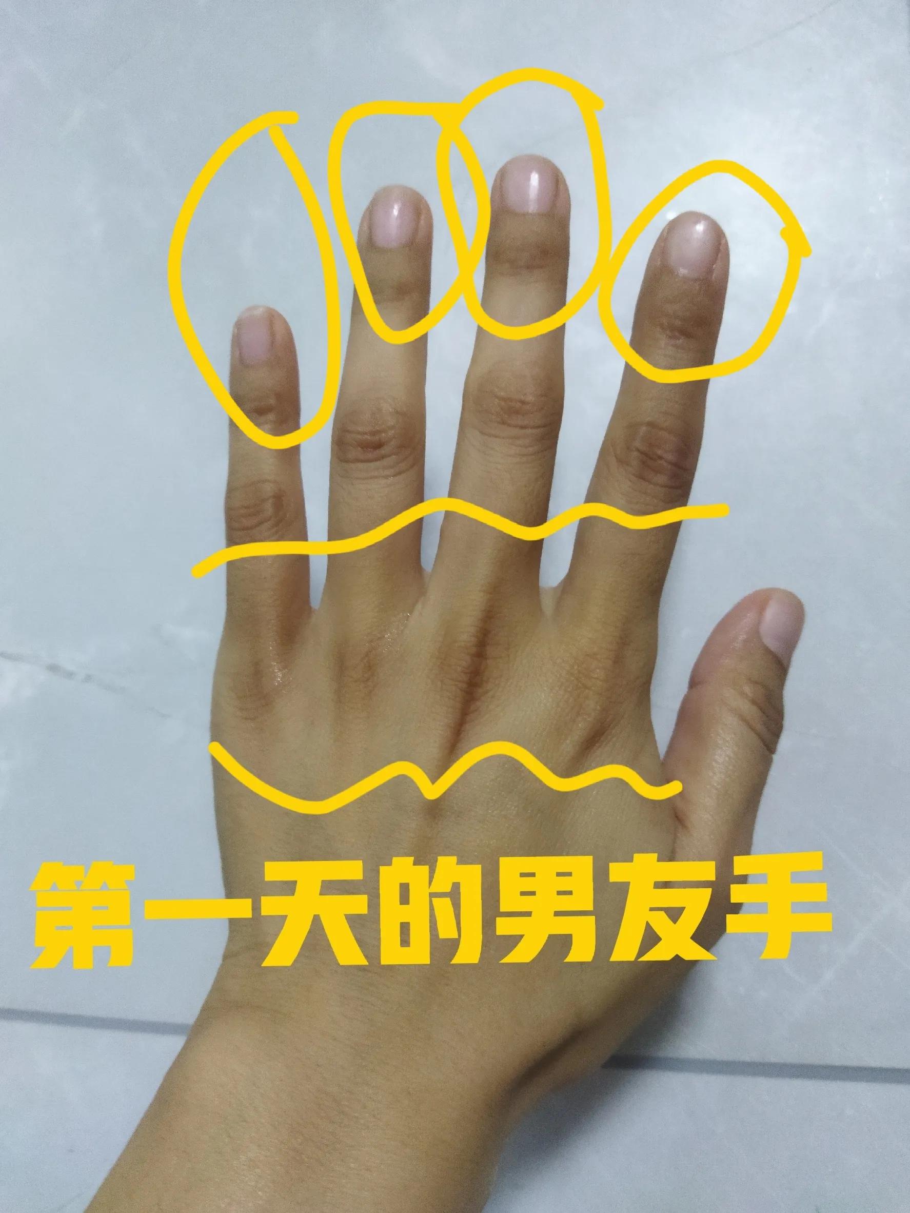 肘关节发黑变白要多长时间,手肘膝盖发黑怎么治