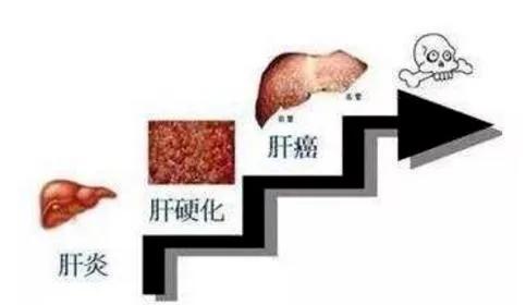 楚雄州人民医院肝胆外二科,四川省人民医院肝胆外科治疗肝癌