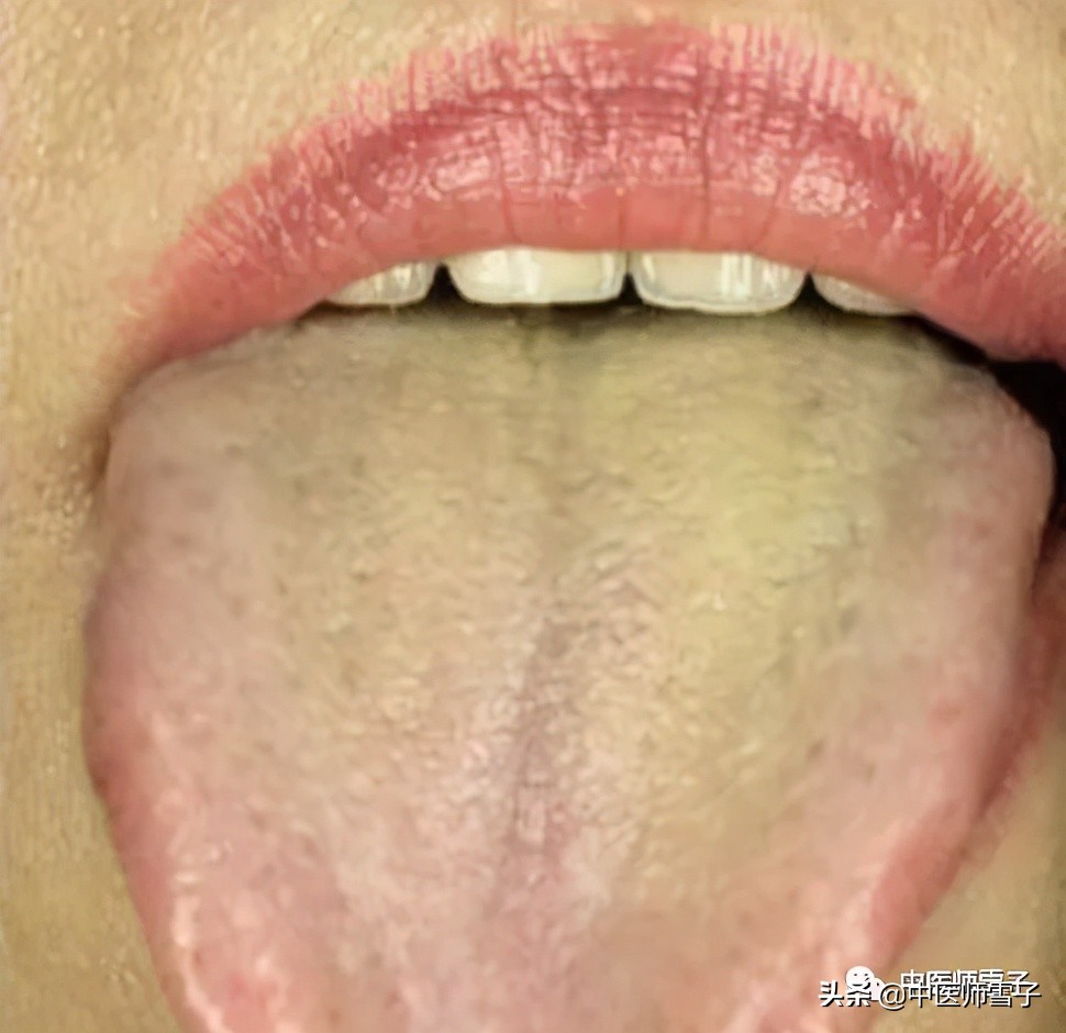 小满养生节气操,小满节气吃哪种食品更养生