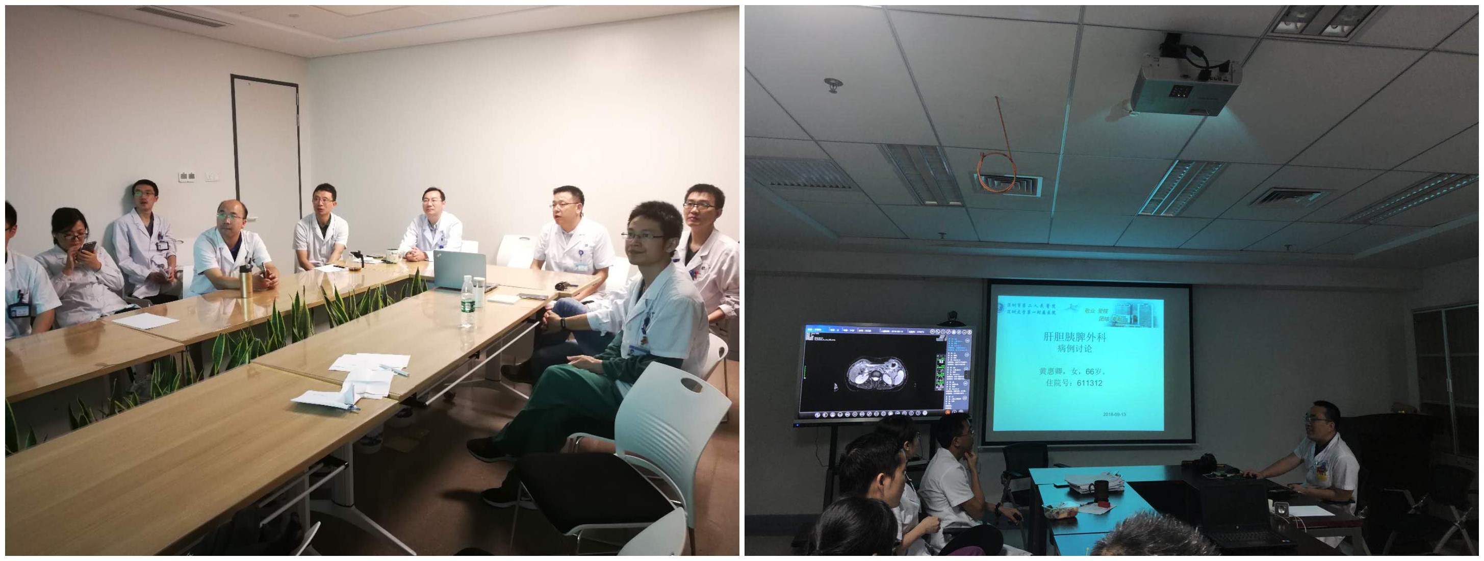 20名专家联手9小时切除罕见肿瘤,顶尖专家切除肝脏肿瘤