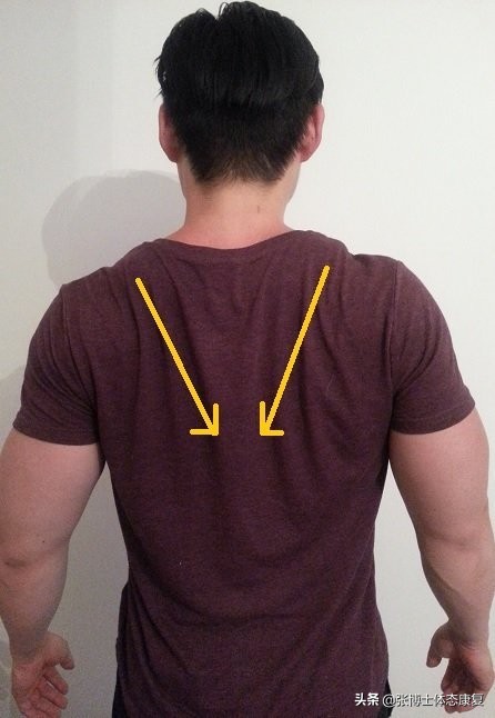 【体态矫正】耸肩、圆肩体态的矫正训练方法