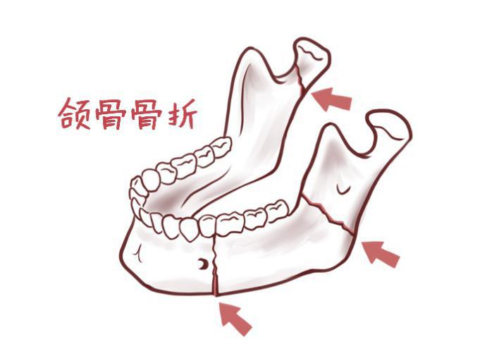新型肺炎来袭，口腔疾病非急诊不建议就医