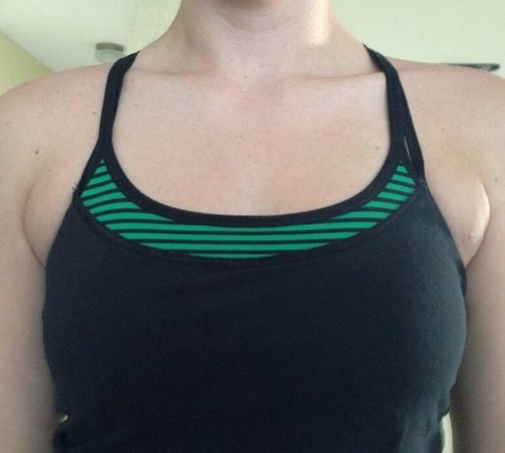 孕期，我长了一对“副乳”，医生说很常见