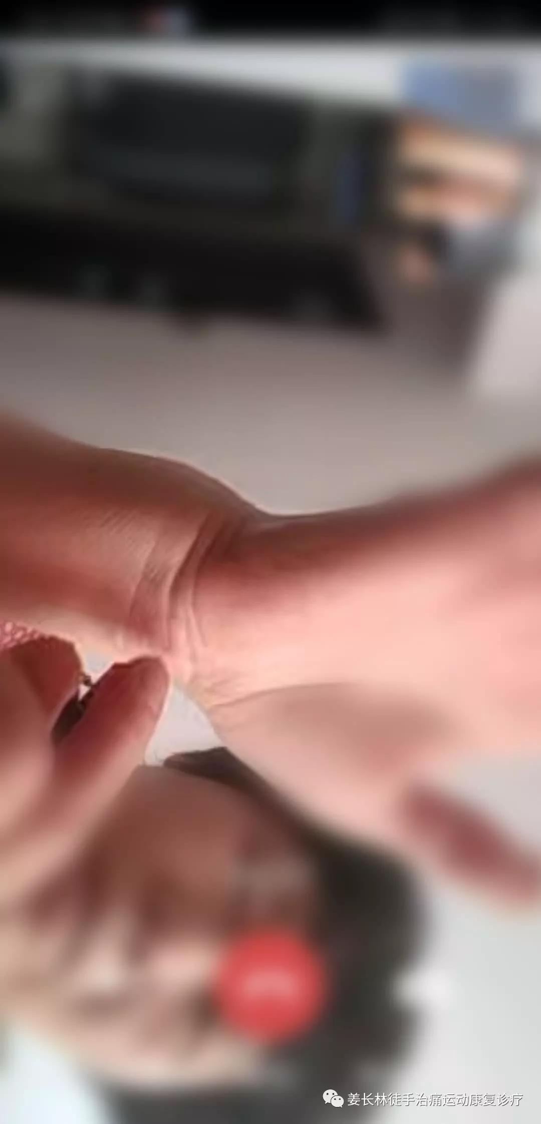 日常生活中的疼痛1—手麻（长时间玩手机）的判断和自我纠正