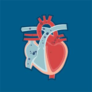 目前的心脏起搏器多少一个,心脏起搏器最高价格多少