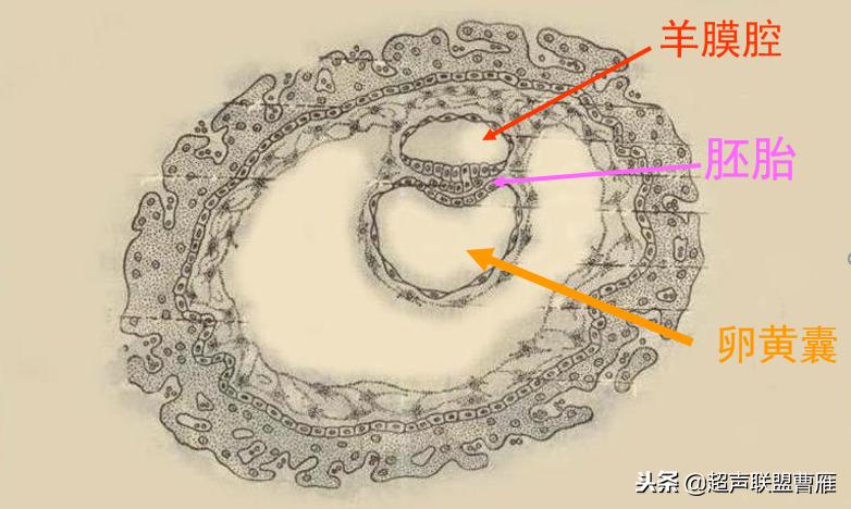 3毫米卵黄囊未见胎芽正常么,40多天的卵黄囊