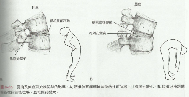 腰疼椎管狭窄压迫神经怎么治疗,腰疼椎管狭窄有什么办法