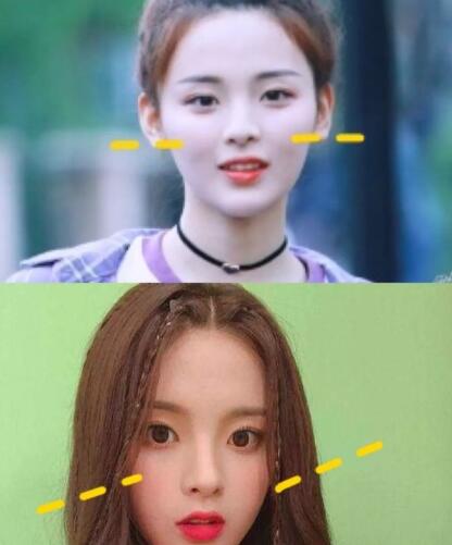 颧骨高太阳穴凹陷怎么改变面相,人中长颧骨高适合什么发型