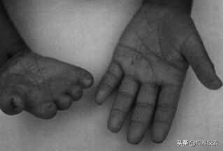 你的胎记在哪个位置看出你的含义,你的胎记在哪里找