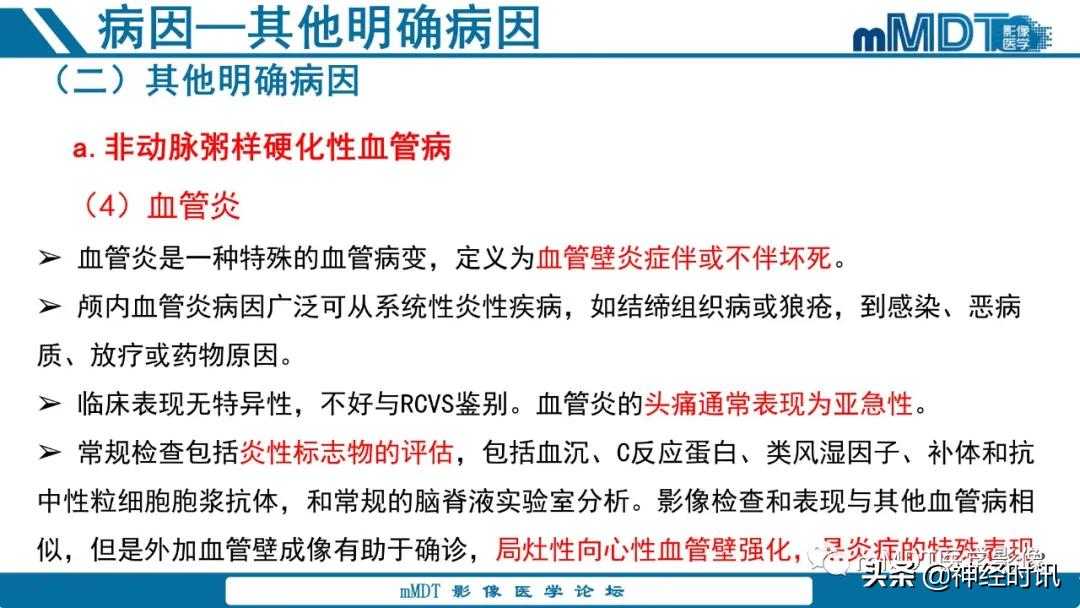急性缺血性脑卒中ppt素材图片,青年缺血性脑卒中ppt