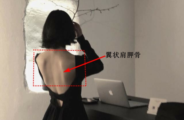 手臂肌肉分布图前锯肌,前锯肌劳损会导致手臂酸痛吗