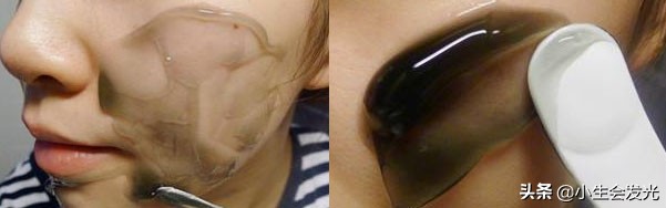 上门祛黑头粉刺,男士祛黑头推荐