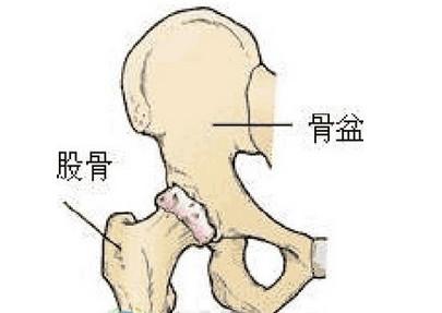 女性左胯疼可能有三种病,大胯痛的几种原因