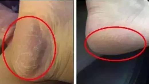 李佳琦卖断货的国货,李佳琦凡士林晶冻唇膏