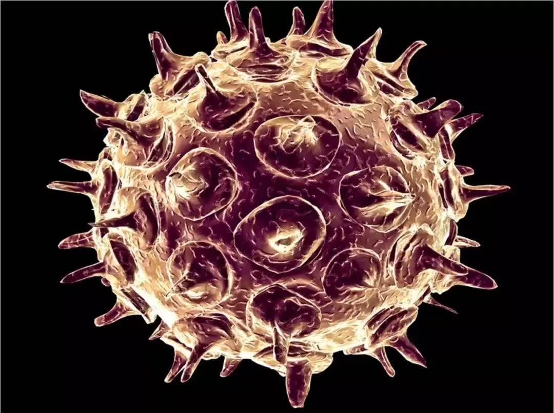 带状性疱疹和缠腰蛇是一样的吗,带状疱疹蛇缠腰会传染吗