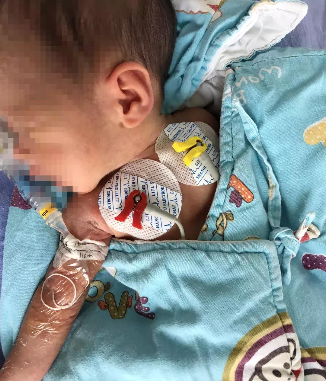 景市一院成功开展新生儿经外周静脉置入中心静脉导管（PICC）术