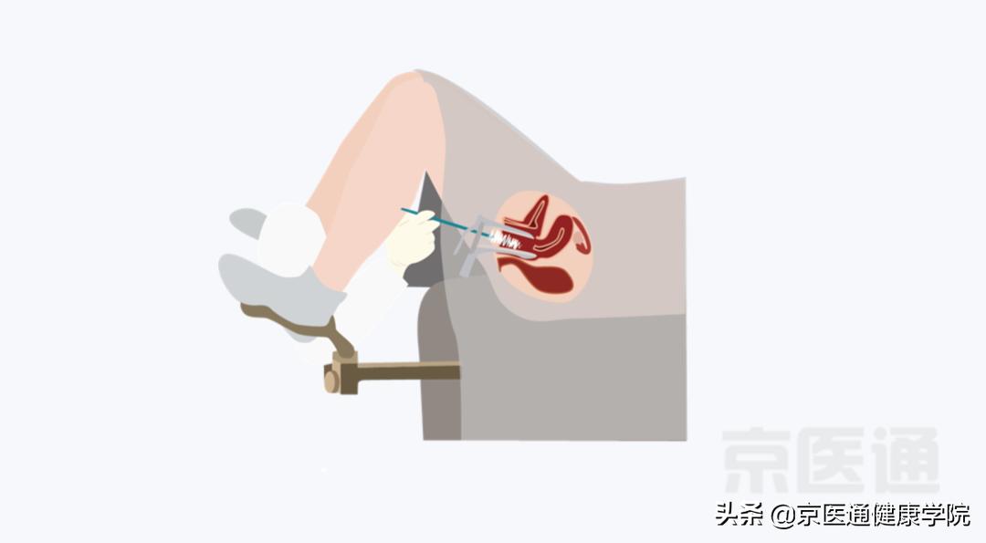 肺癌胃癌淋巴癌哪个最好治疗,肺癌右侧肿瘤晚期如何解决