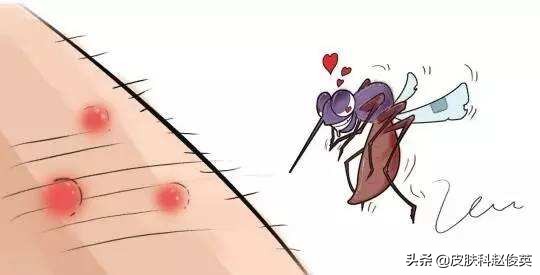 虫咬住了怎么办,被虫咬后出现什么症状要注意