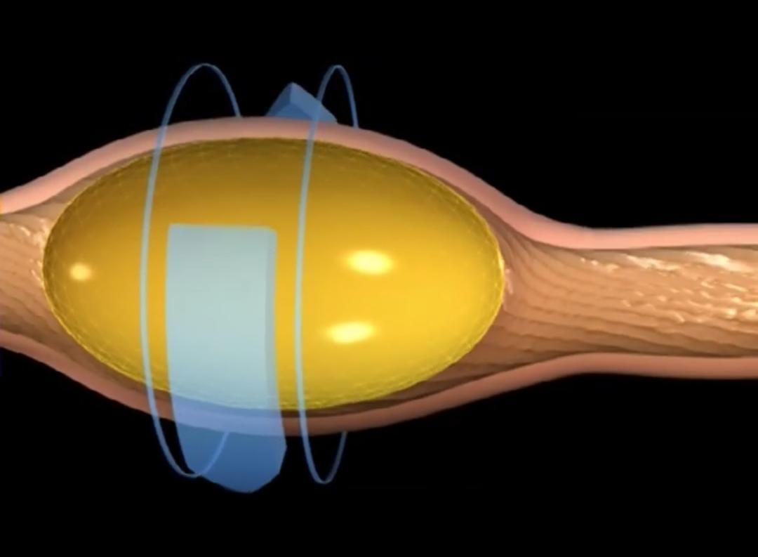 超生动|家禽生殖系统结构和禽蛋形成过程